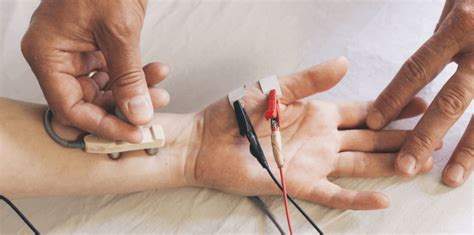 emg-ncv test price philippines|Electromyography and Nerve Conduction Velocity (EMG.